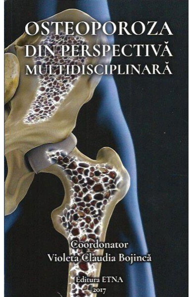 Osteoporoza din perspectiva multidisciplinara