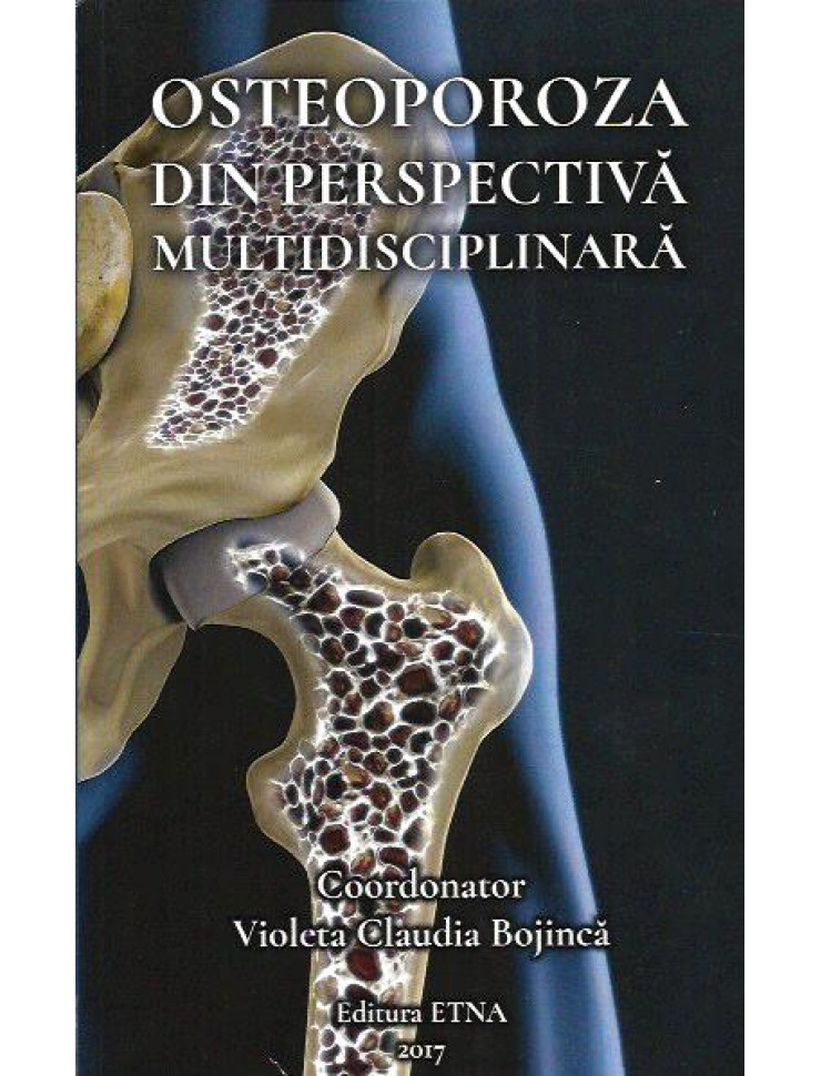 Osteoporoza din perspectiva multidisciplinara